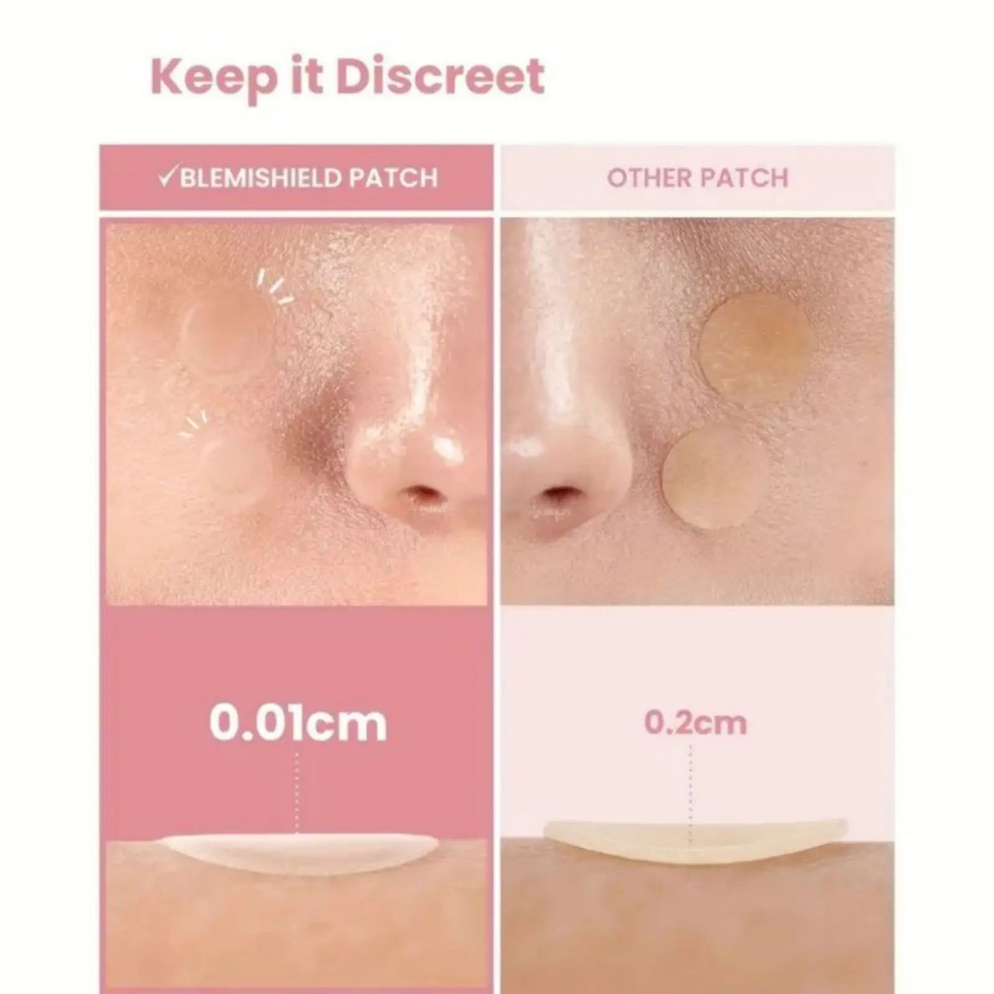 40 pieces of ultra thin pimple patches
